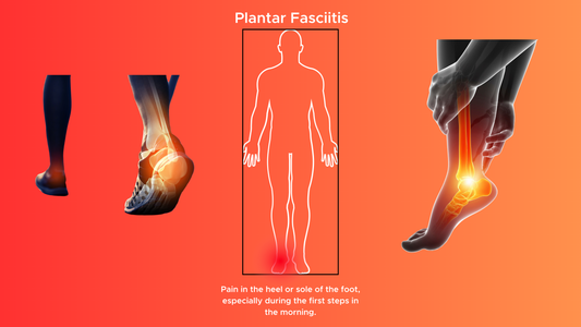 Plantar Fasciitis: Walking on Fire
